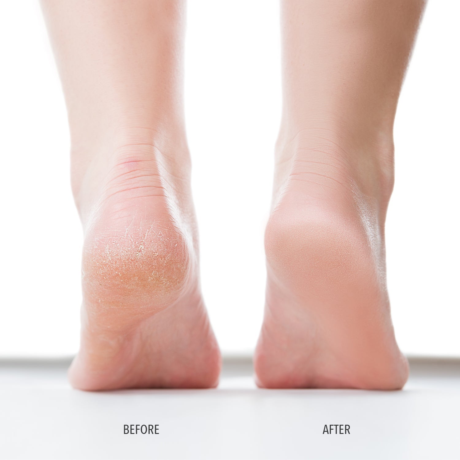 Londontown - Foot Balm - Foot Care - Nail Polish at Beyond Polish